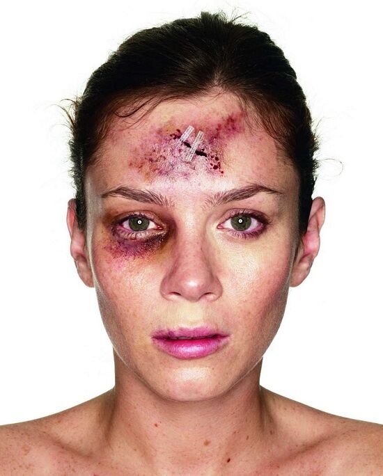 Domestic Violence Domestic Violence