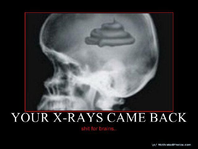 &quot; SHIT FOR BRAINS &quot;!?X
