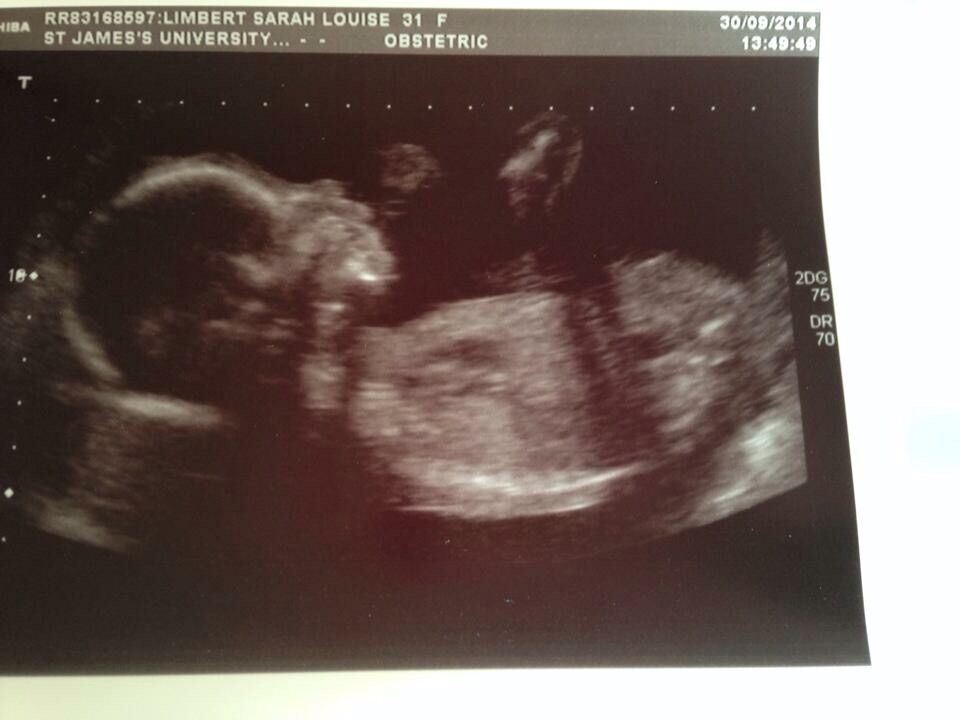 I'm having a boy :) I'm having a boy :)
