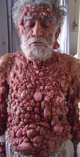 I am not my disease 