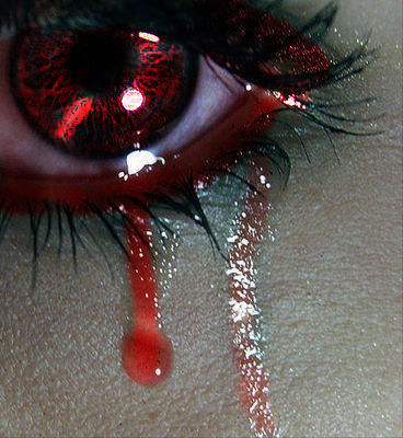 Broken Broken