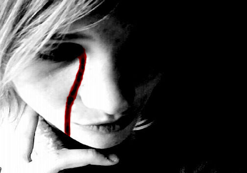 Bleeding out