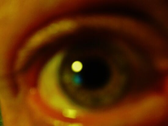 My Right Eye