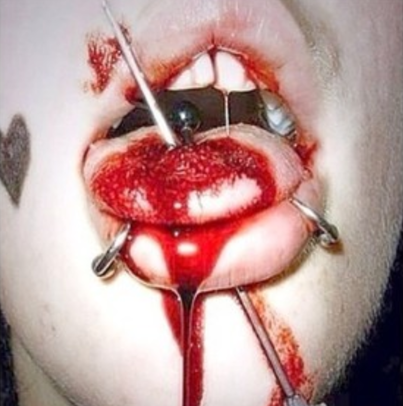 Gore On The Tips Of Tongues