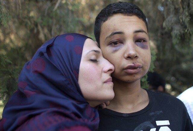 Palestinian Boy (Battered By Isreali Soilders) Palestinian American he is