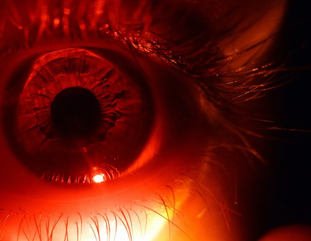Eye see you