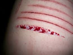 My Pain