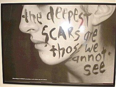 Visible Scars