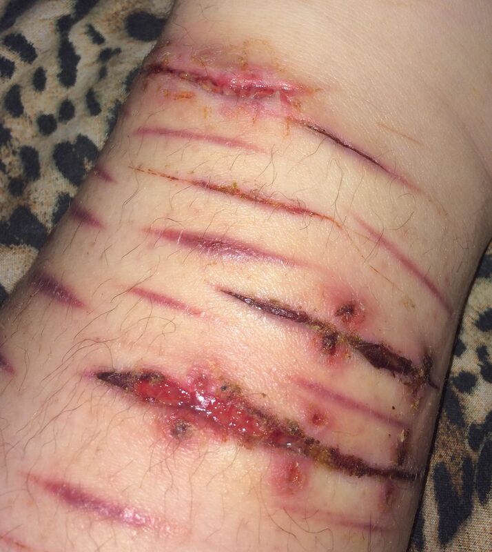 Scars Are What They Are