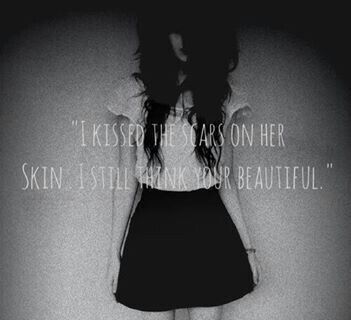 Kiss her scars away
