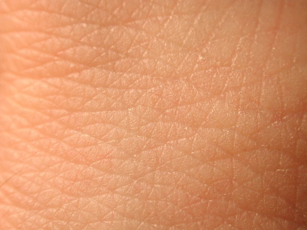My skin