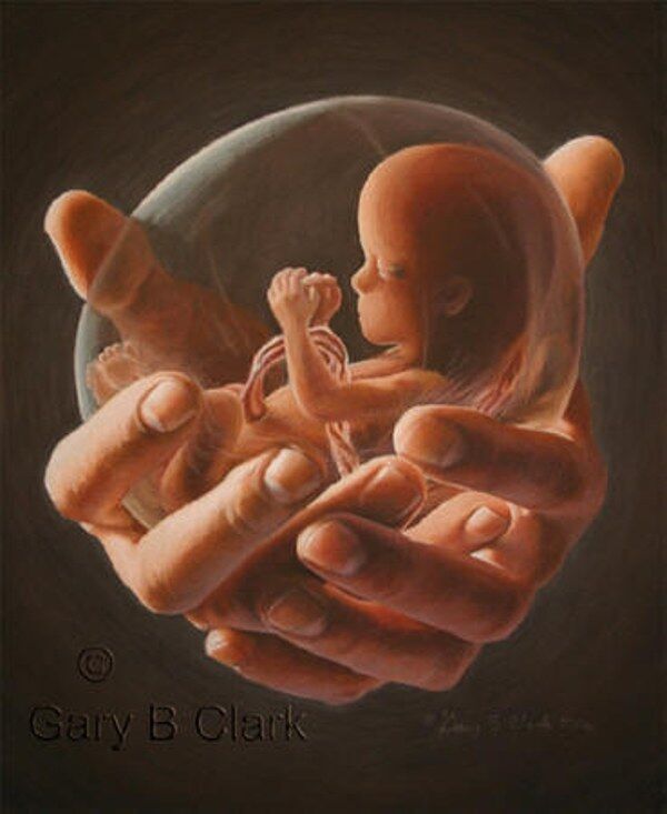 Birth of a Dream
