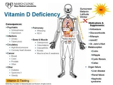 Lacking Vitamin D! (in the uk)