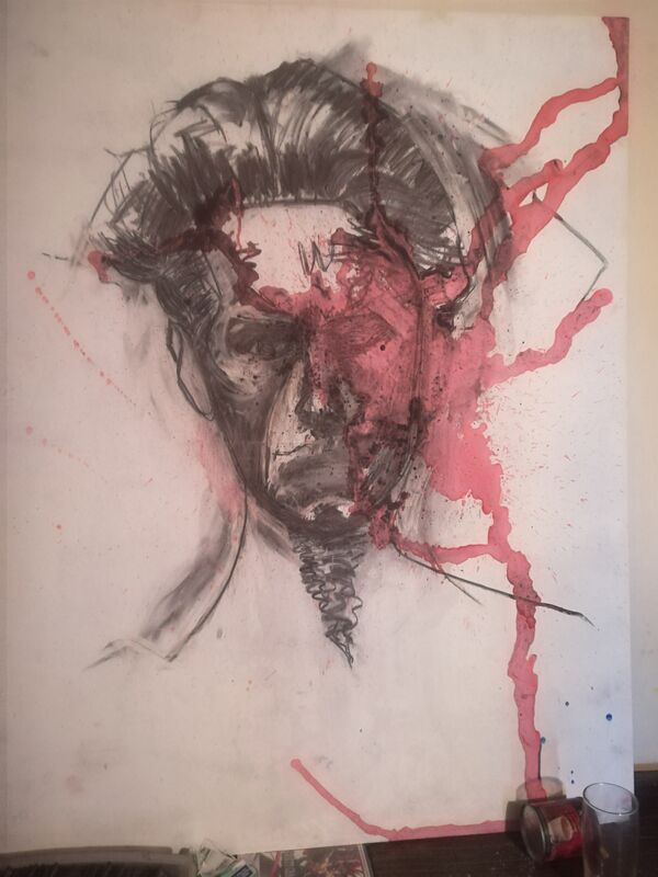 Hemorrhage 