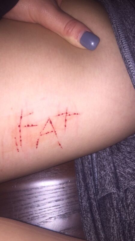 F.A.T.