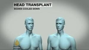 I Wanna Head Transplant