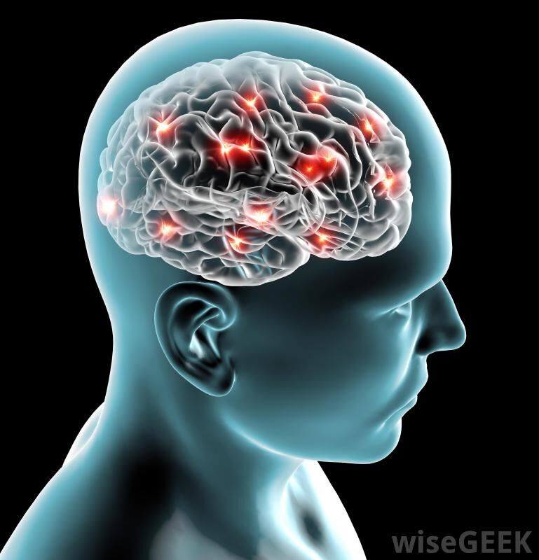 A Cerebral Issue