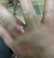 Splinter Within