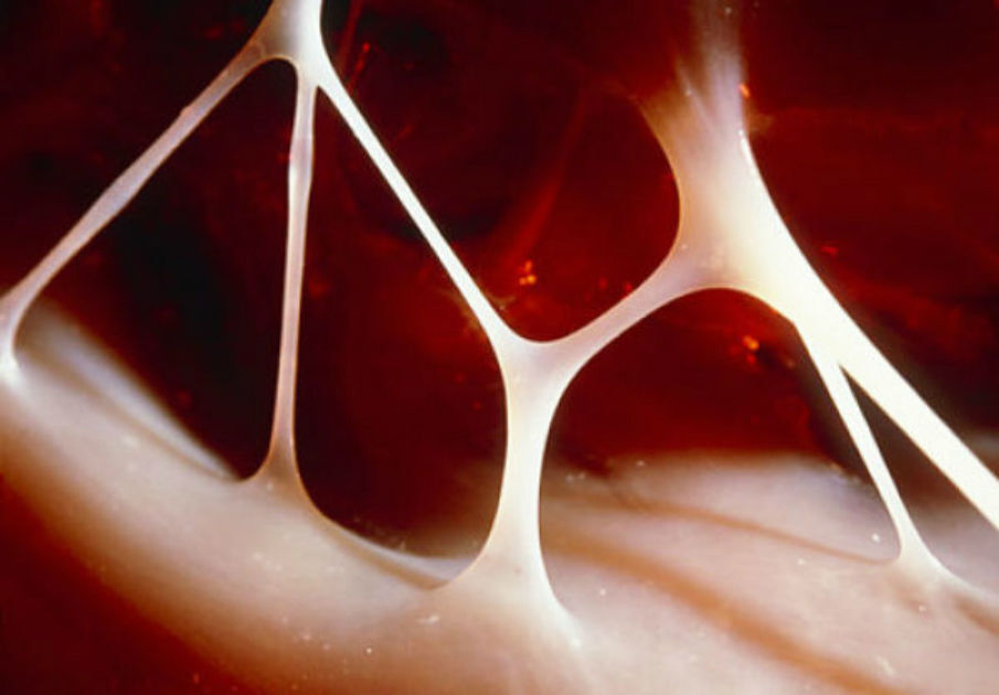 Heart BrAche