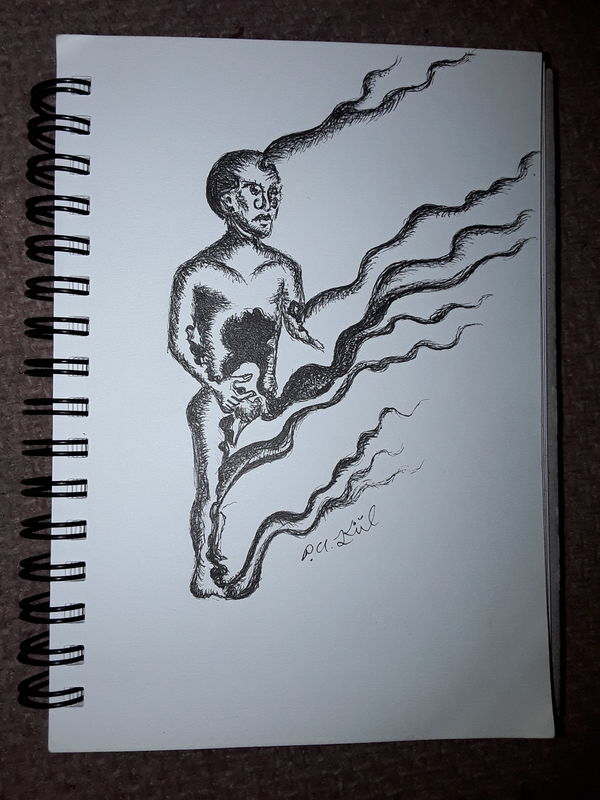 Burned man