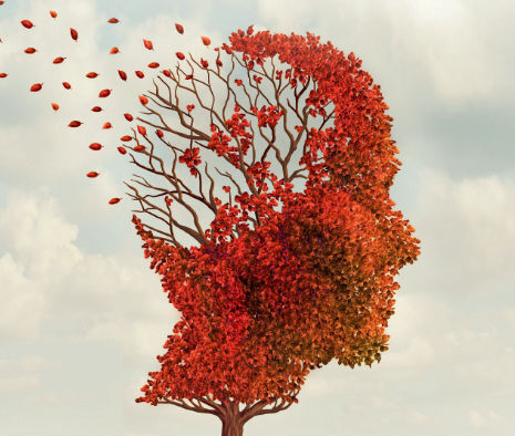 Alzheimers