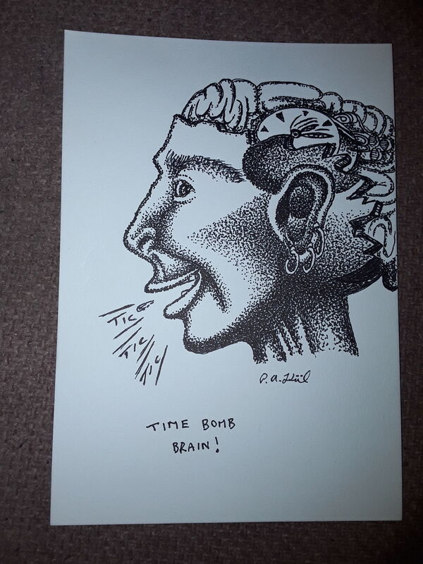 Time bomb brain 