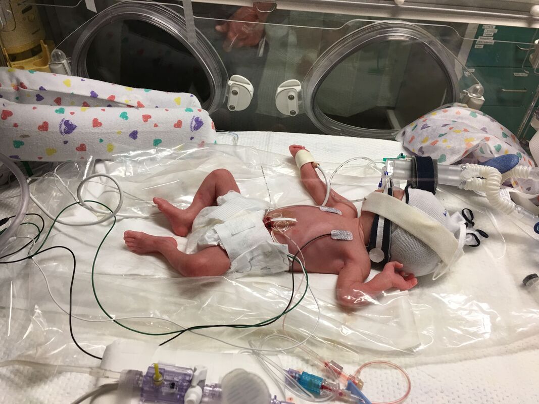 NICU