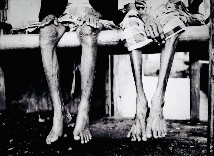 Tough Feet