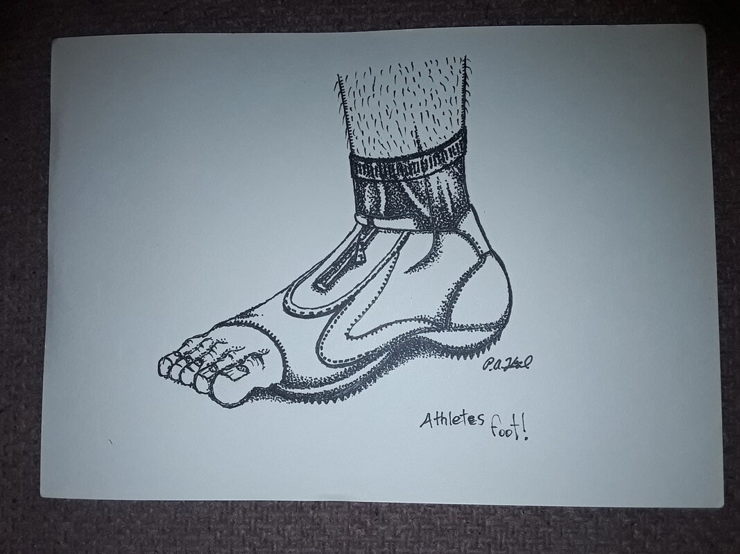 Athlete's foot 