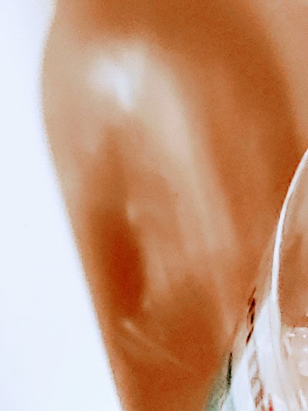 Hits retarded uncon ed