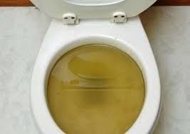 Defecation clogged toilet bowl...