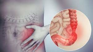Fraught With IBS Irritable Bowel Syndrome...