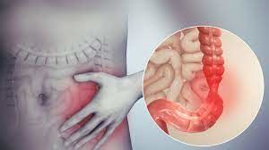 Fraught With IBS Irritable Bowel Syndrome...