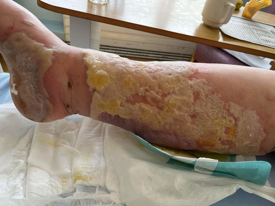 A Skin Full
