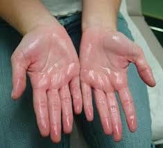 No matter I got prescribed Glycopyrrolate 2 mg tablets taken four times a day...,