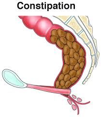 Prolonged offal bout courtesy constipation... redux revisited