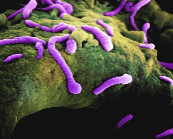 INFECTION Of POSSIBILITIES