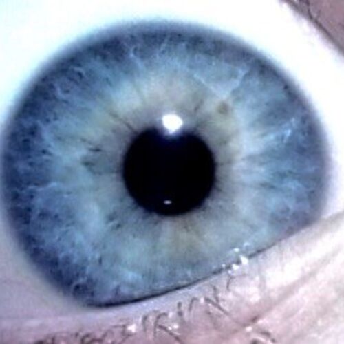 my eye