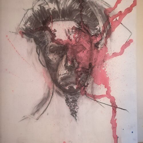 Hemorrhage 