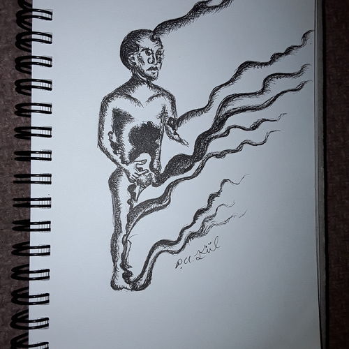 Burned man