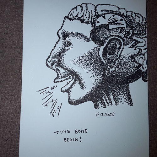 Time bomb brain 