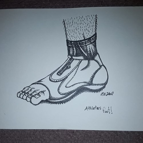 Athlete's foot 