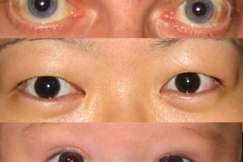 Eyes Open