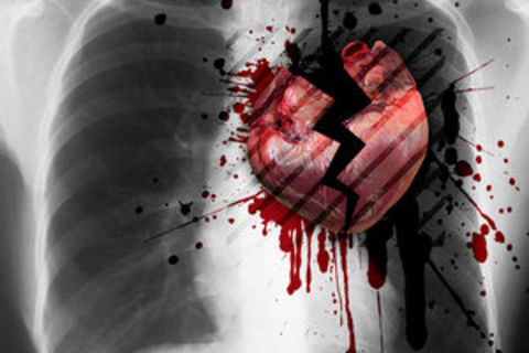 Broken Heart