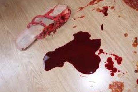 Lover&#039;s  Betrayal 