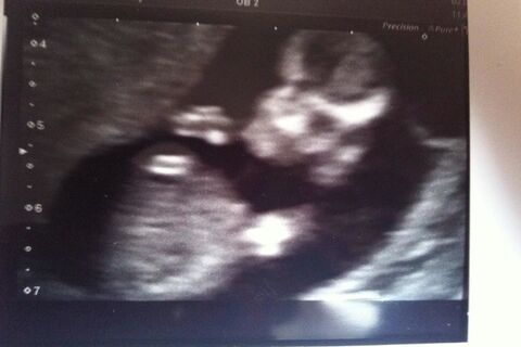 baby bump