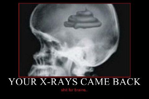 &quot; SHIT FOR BRAINS &quot;!?X