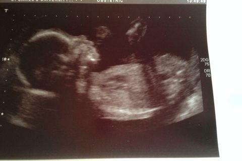 I&#039;m having a boy :)