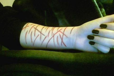 Just a Little Cut
