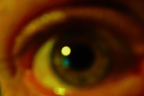 My Right Eye